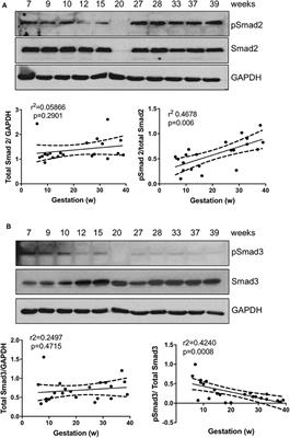 Differential Role of Smad2 and Smad3 in the Acquisition of an Endovascular Trophoblast-Like Phenotype and Preeclampsia